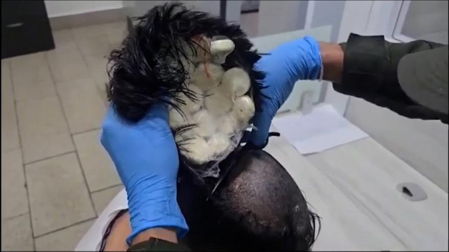 Interceptan en el aeropuerto de Colombia un hombre con un peluquín que llevaba en su interior 10.000 euros de droga