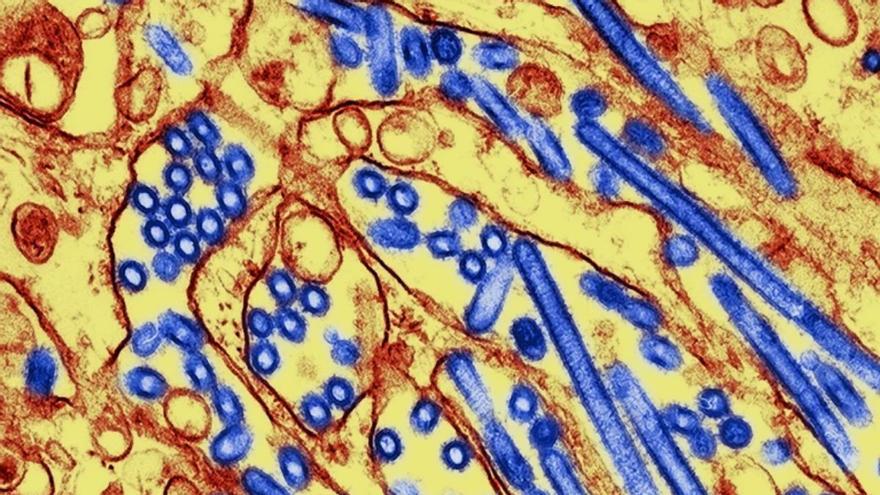 ¿Puede la gripe aviar desatar una nueva pandemia?