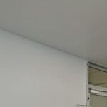 Así funciona la «hemodiálisis del colesterol», la novedosa técnica que ha implantado el HUCA y que ya beneficia a un paciente de Avilés