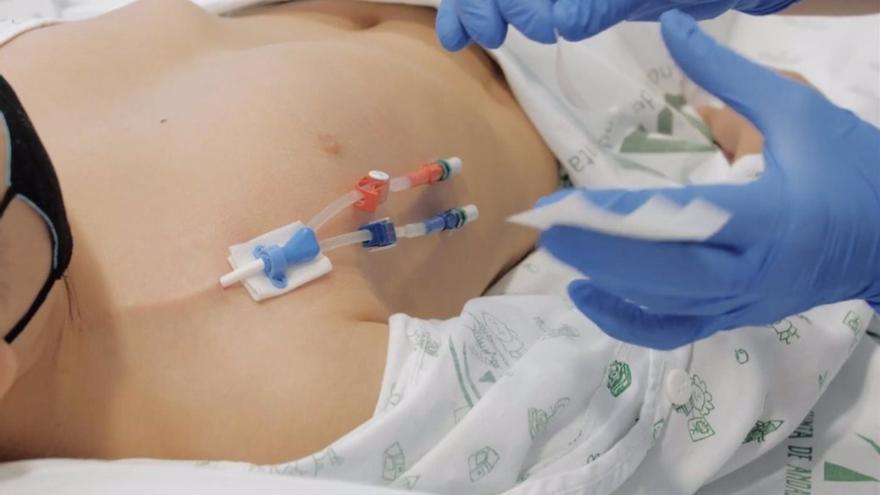 Vivir conectada a una máquina para seguir viviendo: así es el día a día de una paciente pediátrica en diálisis