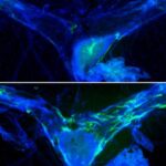 Una buena «limpieza» de residuos cerebrales podría mejorar la memoria
