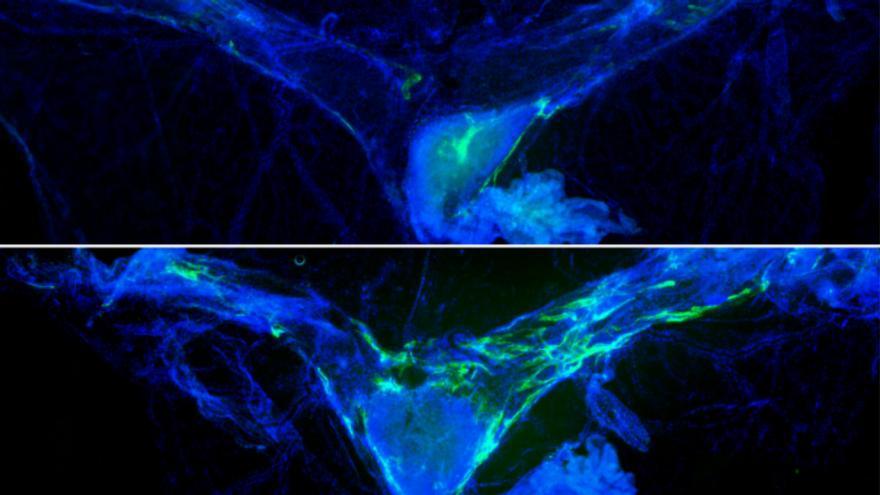 Una buena «limpieza» de residuos cerebrales podría mejorar la memoria