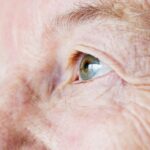 Sarcopenia: Qué es y qué síntomas tiene esta enfermedad, ligada al envejecimiento