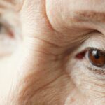 La miopía multiplica el riesgo de padecer glaucoma, la segunda causa de ceguera en el mundo