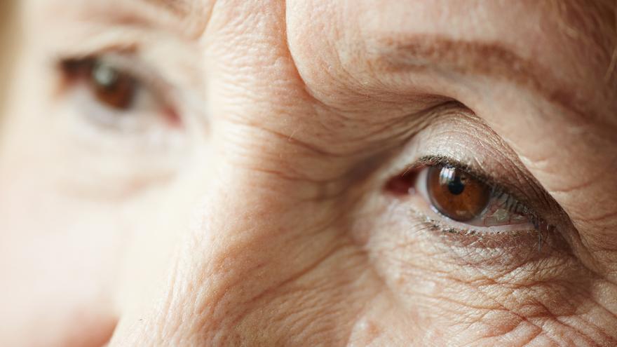 La miopía multiplica el riesgo de padecer glaucoma, la segunda causa de ceguera en el mundo