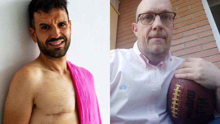 Cáncer de mama en hombres: «Descubrí un pequeño bulto en mi pecho mientras me duchaba, era como una lenteja»
