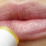 Herpes labial: qué es, síntomas, tratamiento y cómo el estrés influye en su aparición