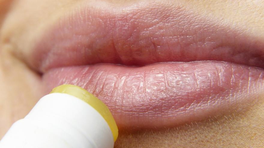 Herpes labial: qué es, síntomas, tratamiento y cómo el estrés influye en su aparición