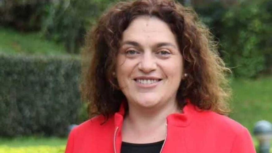 Así es la acromegalia, la enfermedad que sufre Begoña: «Los anillos me quedaban pequeños y cada vez usaba zapatos más grandes»