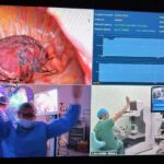 El doctor Diego González Rivas opera desde China un tumor en Rumanía