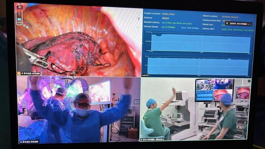 El doctor Diego González Rivas opera desde China un tumor en Rumanía