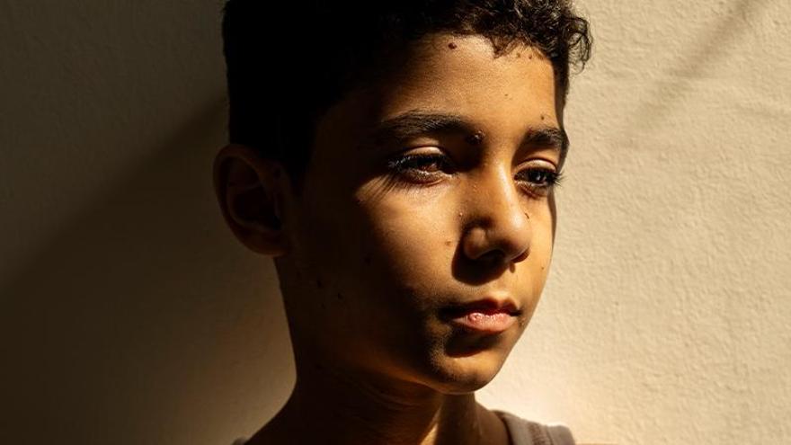 Un niño gazatí mutilado por un ataque israelí, la fotografía ganadora del World Press Photo