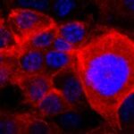Síntomas para descubrir a tiempo la enfermedad más mortífera y difícil de diagnosticar