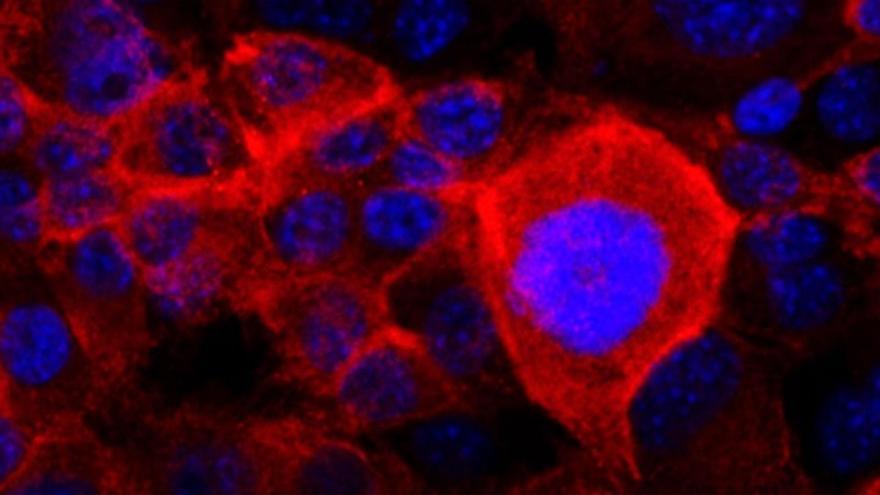 Síntomas para descubrir a tiempo la enfermedad más mortífera y difícil de diagnosticar