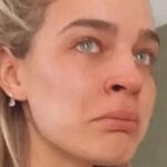 Preocupación por Laura Escanes ha compartido tras publicar unas polémicas imágenes en Instagram llena de moratones: «Esta tortura…»