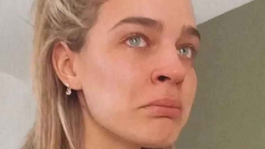 Preocupación por Laura Escanes ha compartido tras publicar unas polémicas imágenes en Instagram llena de moratones: «Esta tortura…»
