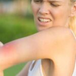 El sorprendente truco del gel de ducha con el que evitarás que te piquen los mosquitos