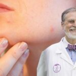 Jerónimo Ors, farmacéutico: «El sol y el calor pueden provocar el temido acné de Mallorca en tu piel»