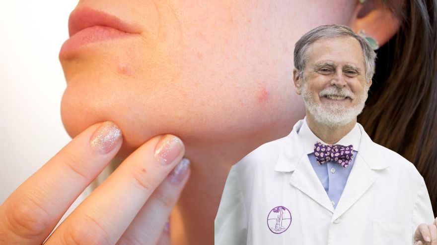 Jerónimo Ors, farmacéutico: «El sol y el calor pueden provocar el temido acné de Mallorca en tu piel»
