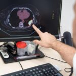 El Gobierno plantea que los empleados de baja por cáncer, infarto o ictus puedan volver progresivamente al trabajo