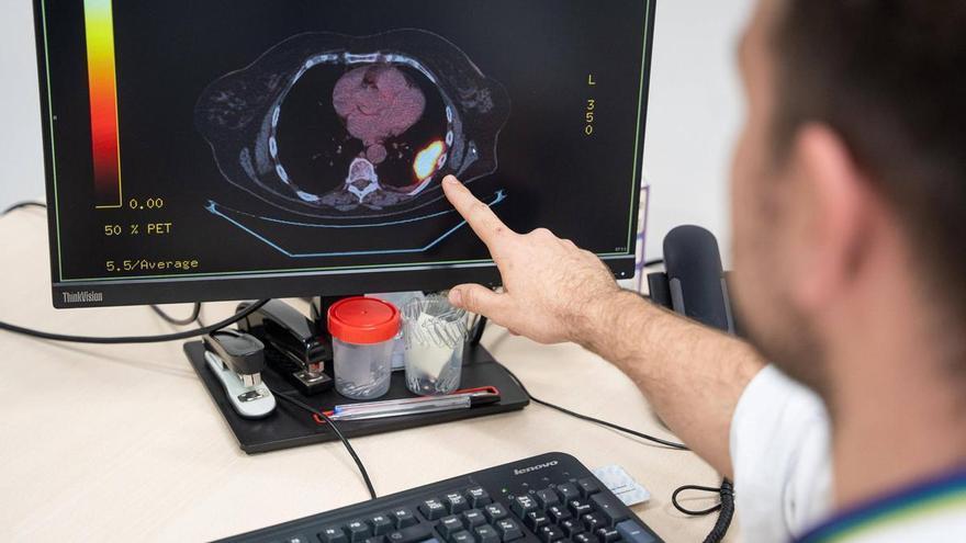 Un estudio apunta a que la vitamina D ayuda a la recuperación de los pacientes tras un ictus